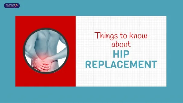 Are You Looking For Hip Replacement In India