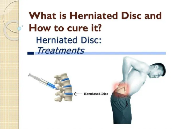 what is herniated disc and how to cure it