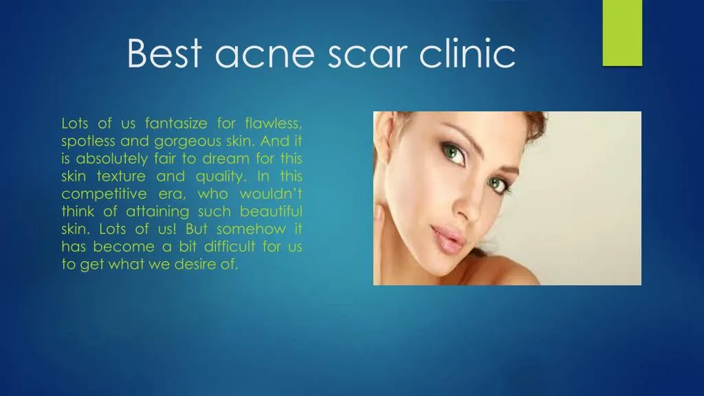 best acne scar clinic