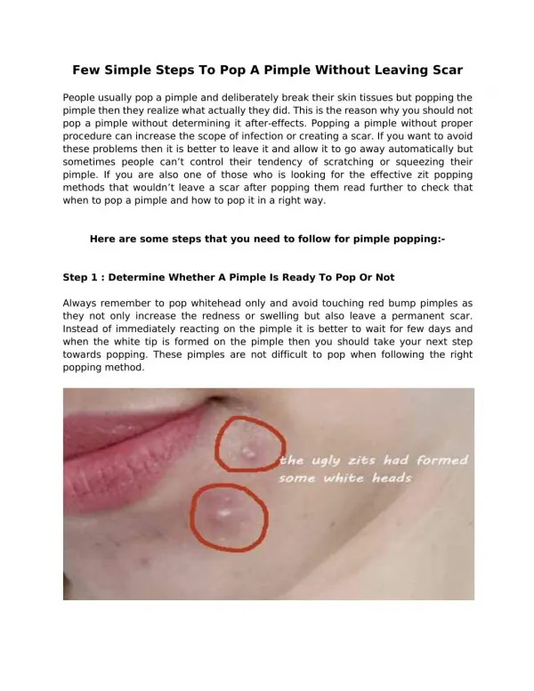 Few Simple Steps To Pop A Pimple Without Leaving Scar