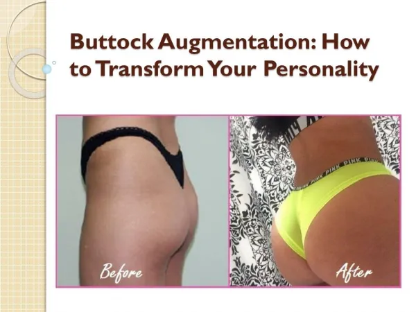 Buttock Augmentation: How to Transform Your Personality