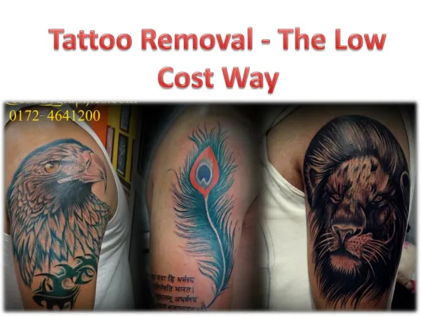Tattoo Removal Chandigarh - The Low Cost Way