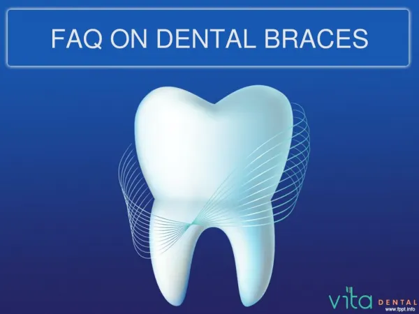 FAQ: Care for Teeth while wearing braces