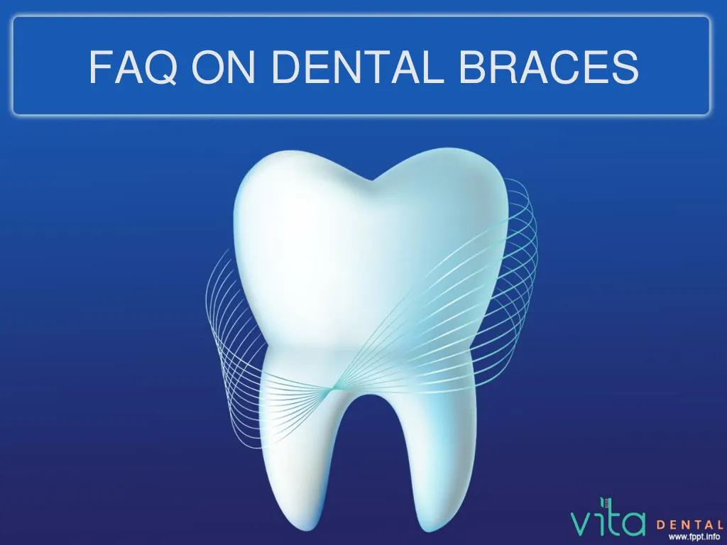 faq on dental braces