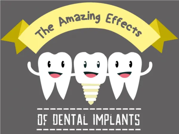 The Amazing Effects of Dental Implants