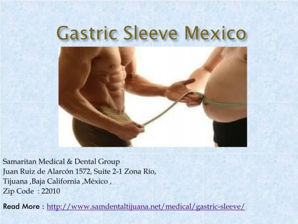 Gastric Sleeve in Mexico - Good Service weight Loss