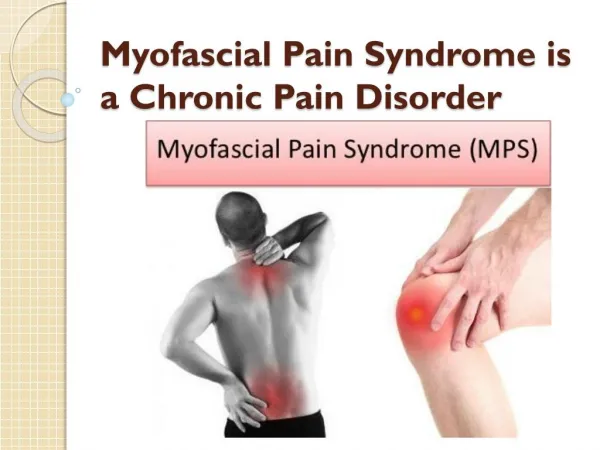 Symptoms of Myofascial Pain Syndrome & Treatment