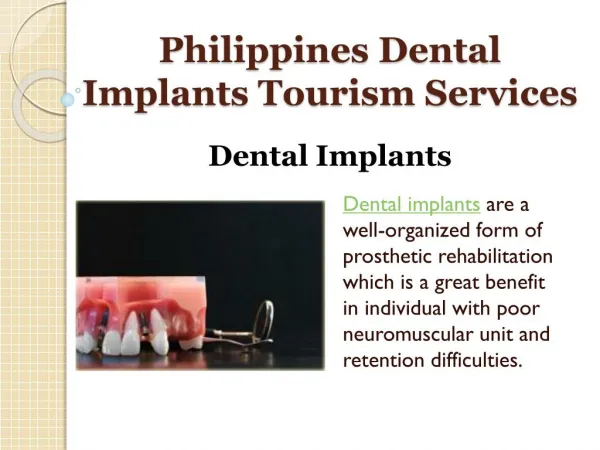 Philippines Dental Implants Treatment