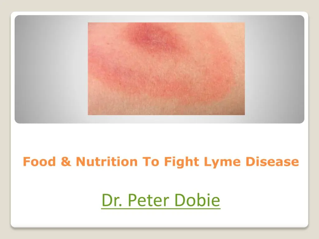 food nutrition to fight lyme disease
