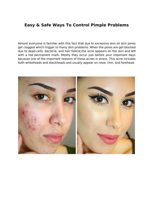 Easy & Safe Ways To Control Pimple Problems