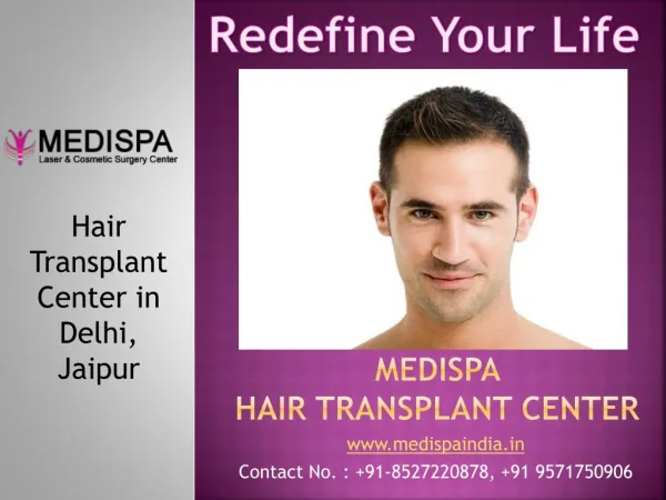 Hair Transplant in Delhi | Hair Transplant in India