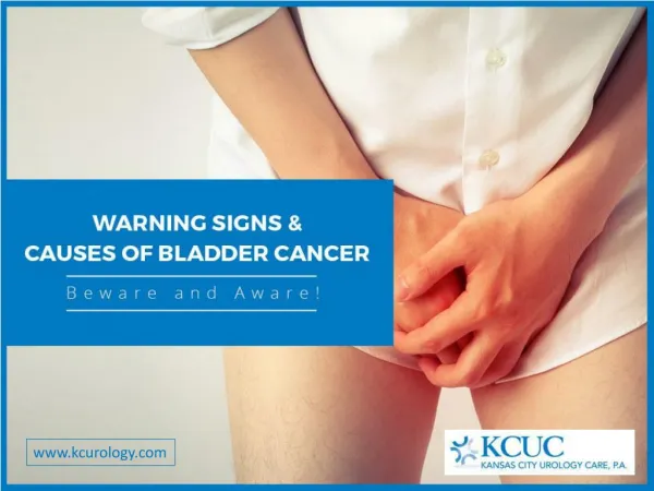 Bladder Cancer Causes, Symptoms and Signs