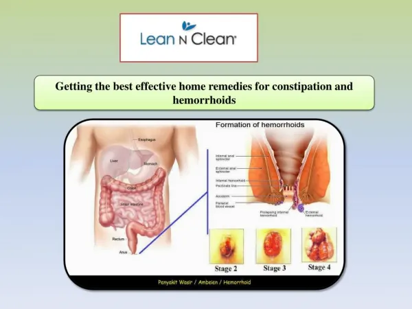 Getting the best effective home remedies for constipation and hemorrhoids
