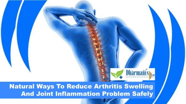 Natural Ways To Reduce Arthritis Swelling And Joint Inflammation Problem Safely