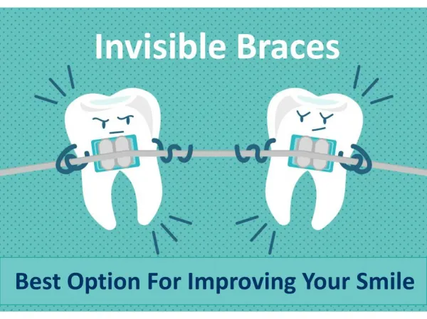 Best Option For Improving Your Smile - Invisible Braces