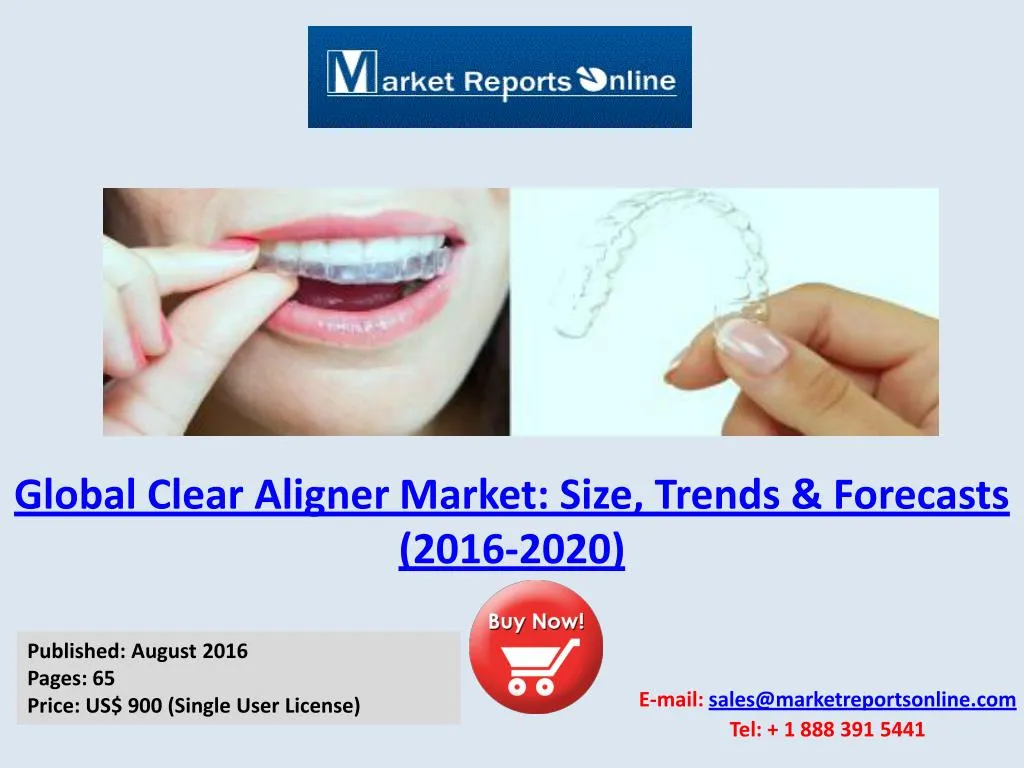 global clear aligner market size trends forecasts 2016 2020