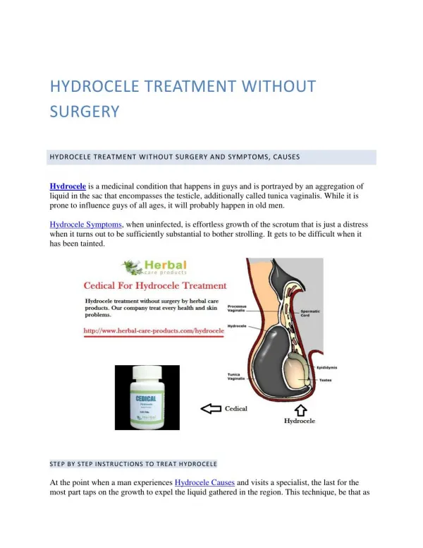 Hydrocele Treatment