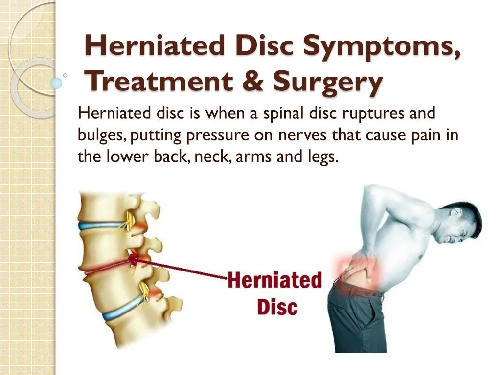 herniated disc symptoms treatment surgery