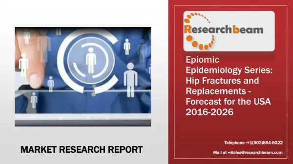 Epiomic Epidemiology Series: Hip Fractures and Replacements - Forecast for the USA 2016-2026