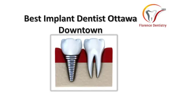 Best Implant Dentist Ottawa Downtown