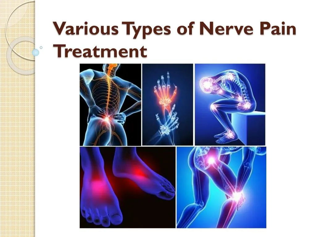 various types of nerve pain treatment