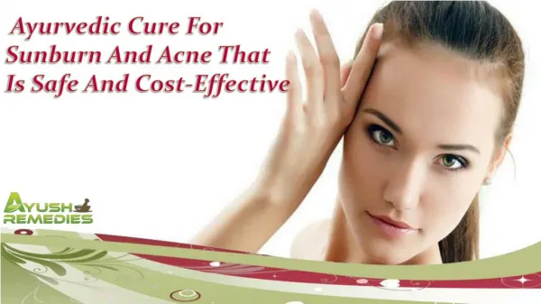 Ayurvedic Cure For Sunburn And Acne That Is Safe And Cost-Effective