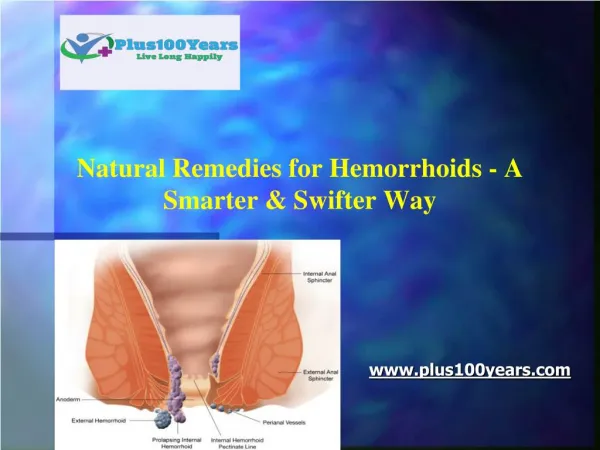 Natural remedies for hemorrhoids - A smarter & swifter way