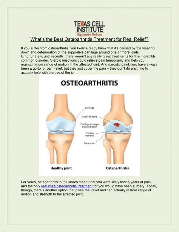 Best Osteoarthritis Treatment for Real Relief - Texas Cell Institute