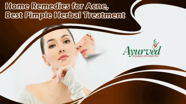 Home Remedies for Acne, Best Pimple Herbal Treatment