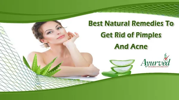 Best Natural Remedies To Get Rid of Pimples And Acne