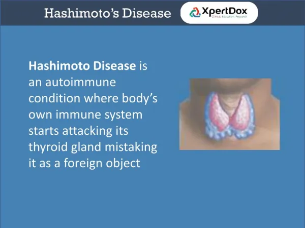 Hashimotos disease