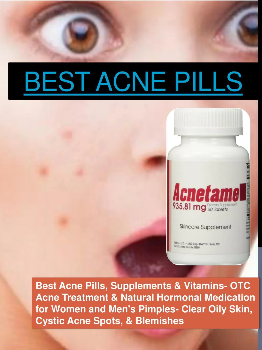 best acne pills
