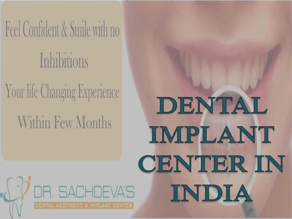 dental implant center in india