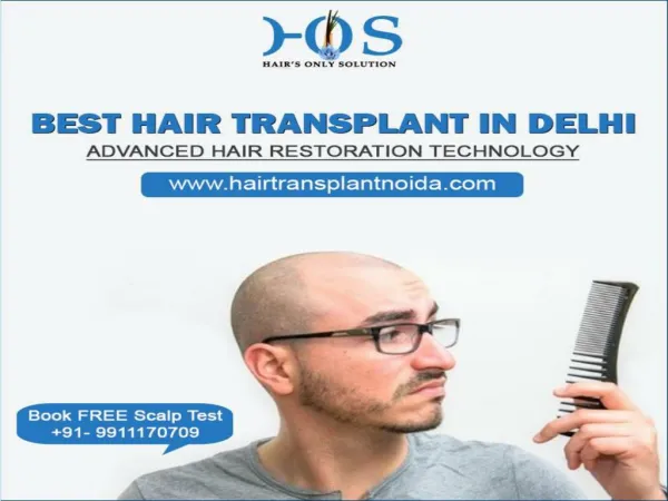 Specialist of Hair Transplant in Delhi