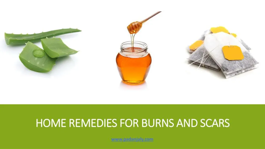 home remedies for burns and scars