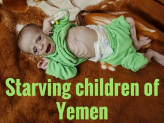 Starving children of Yemen