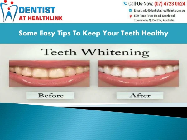 Some Of The Many Solutions For Tooth Whitening Systems