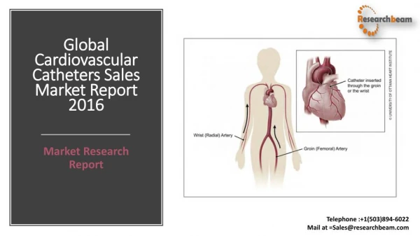 Global Cardiovascular Catheters Sales Market Report 2016