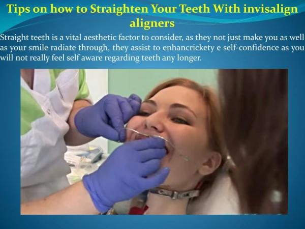 Tips on how to Straighten Your Teeth With invisalign aligners