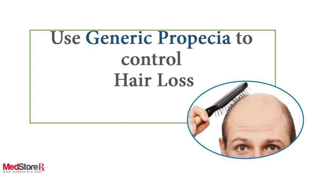 use generic propecia to control hair loss