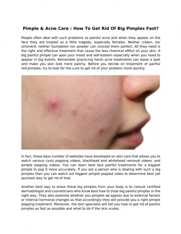 Pimple & Acne Care : How To Get Rid Of Big Pimples Fast?