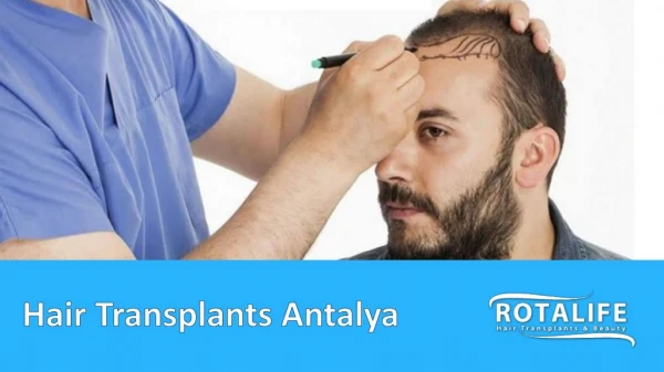 Hair Transplants Antalya