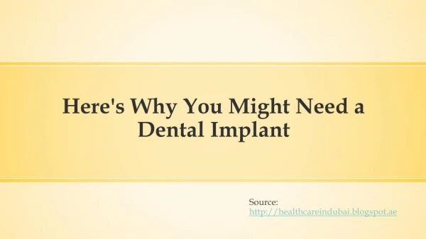 Here's why you might need a Dental Implant