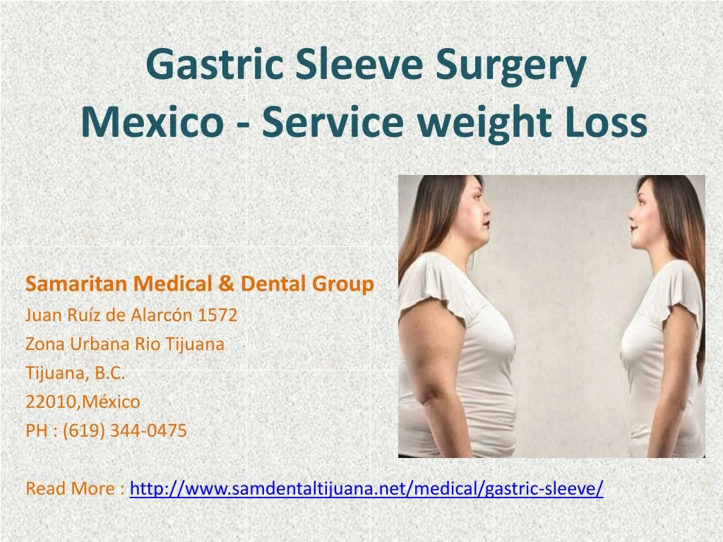 gastric sleeve surgery mexico service weight loss