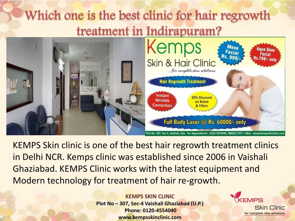 which one is the best clinic for hair regrowth treatment in indirapuram