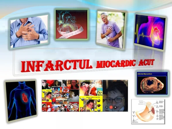 infarctul miocardic acut