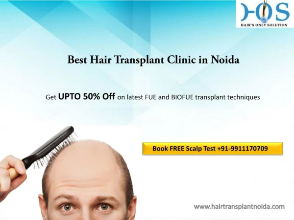 Looking for Best Hair Transplant Treatment Clinic in Delhi Contact HOS 9911170709