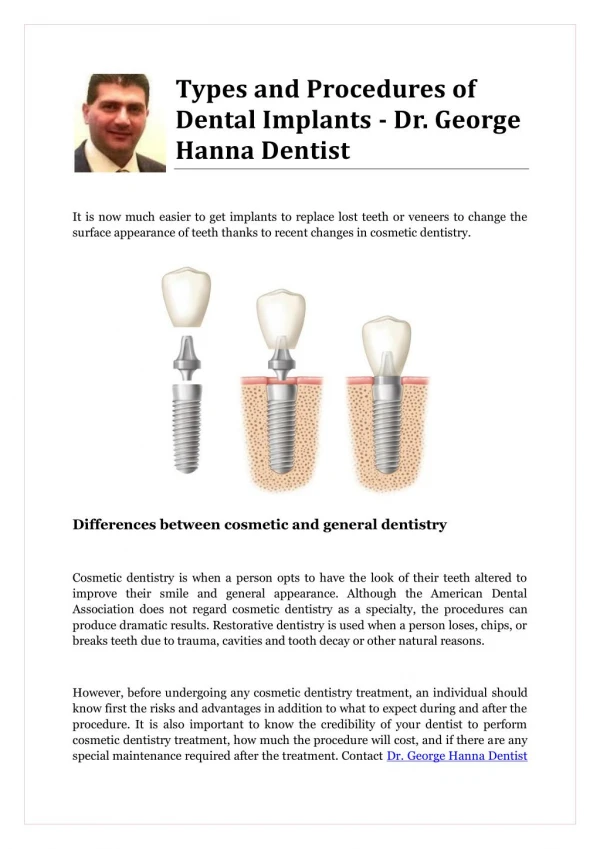 Types and Procedures of Dental Implants - Dr. George Hanna Dentist