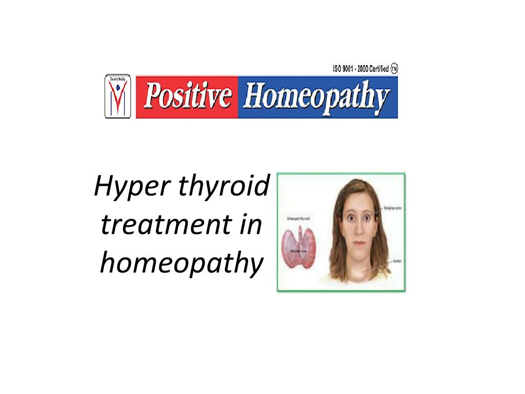 hyper thyroid treatment in homeopathy