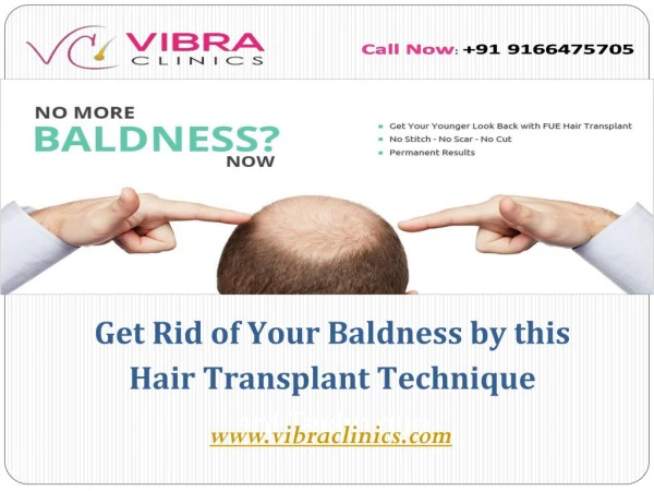 Get rid of your baldness by this hair transplant technique